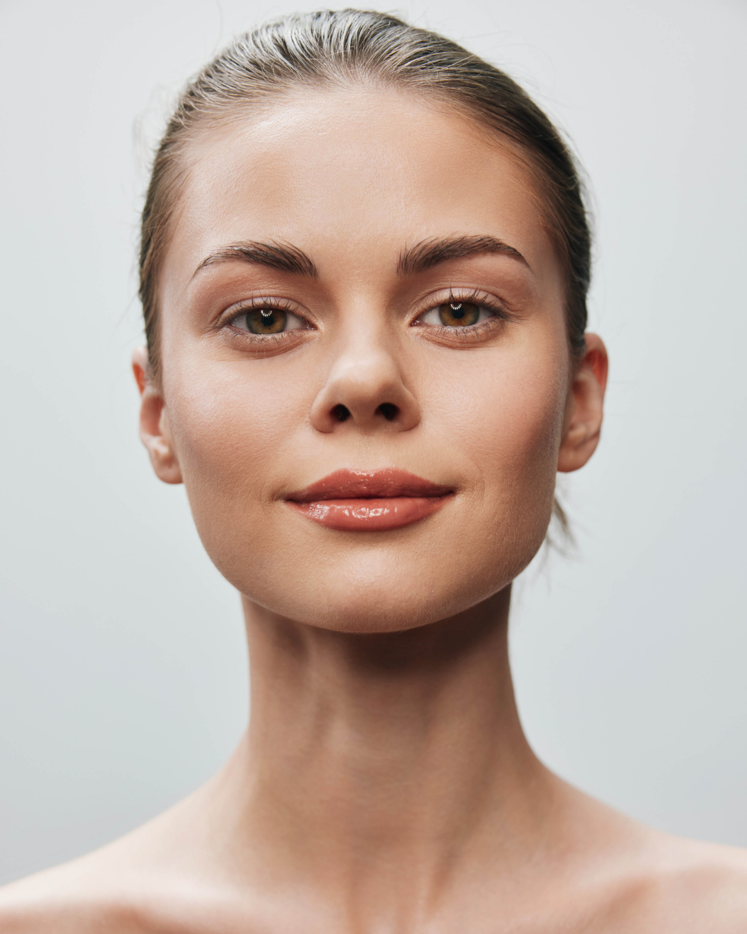 After treatment at Healthy Minds Luxury Med Spa