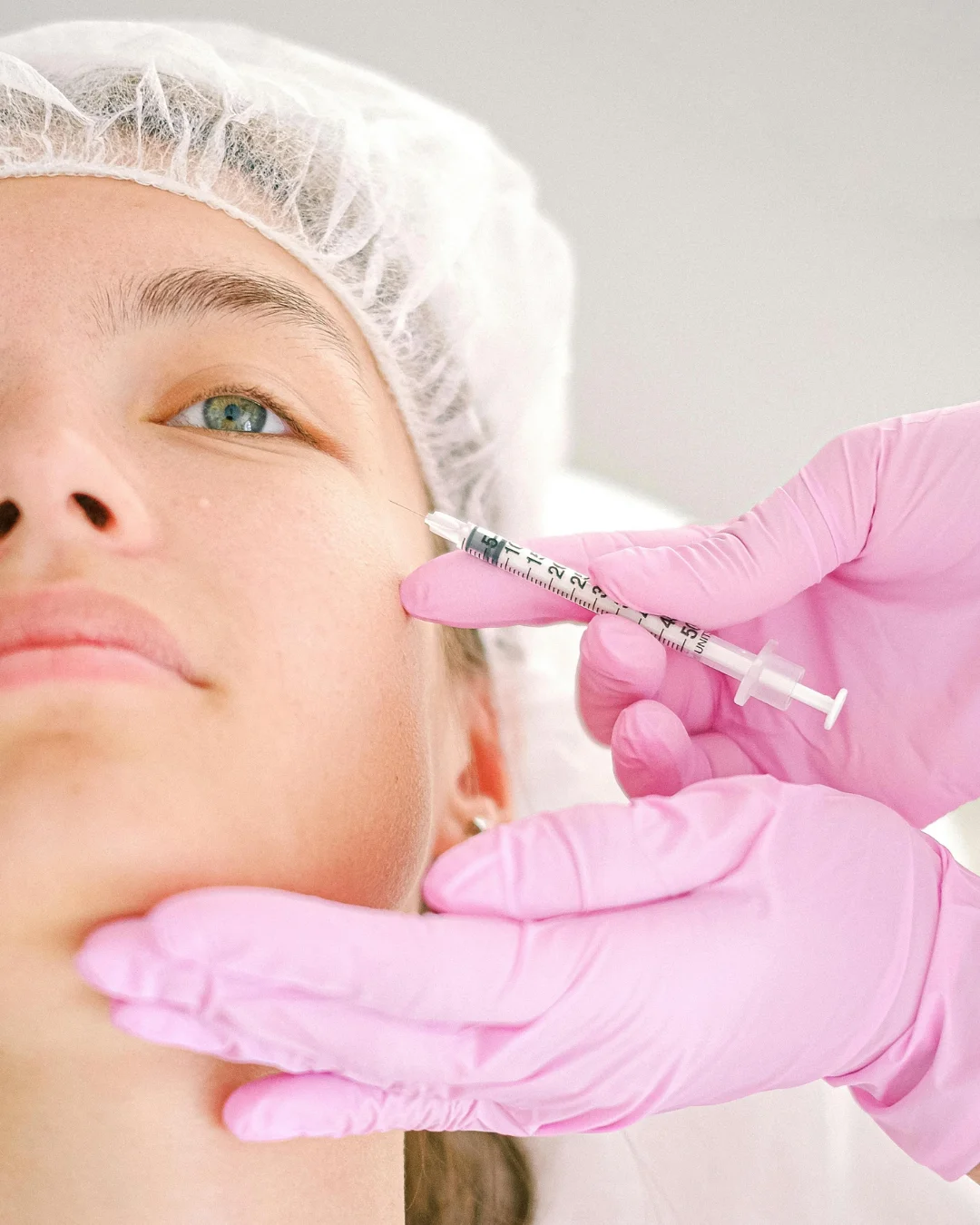 Natural-looking dermal filler results at Healthy Minds Luxury Med Spa