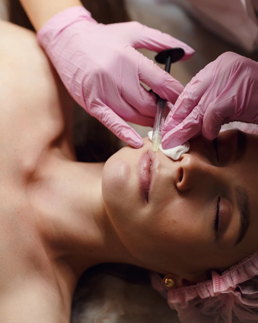 Lip filler injection at Healthy Minds Luxury Med Spa